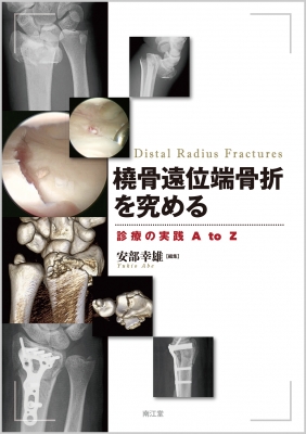 【単行本】 安部幸雄 / 橈骨遠位端骨折を究める 診療の実践A to Z 送料無料