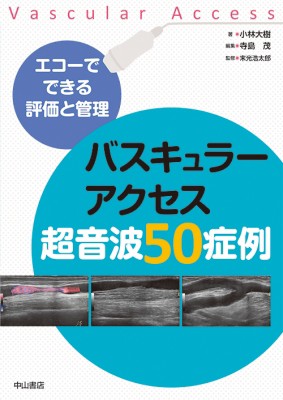 単行本 小林大樹 関西ろうさい病院 中央検査部 エコーでできる評価と管理 バスキュラーアクセス超音波50症例 送料無の通販はau Pay マーケット Hmv Books Online