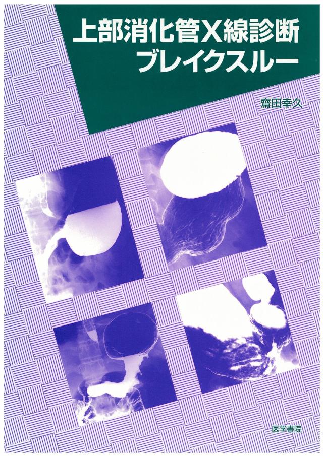 上部消化管X線診断ブレイクスルー(中古品)