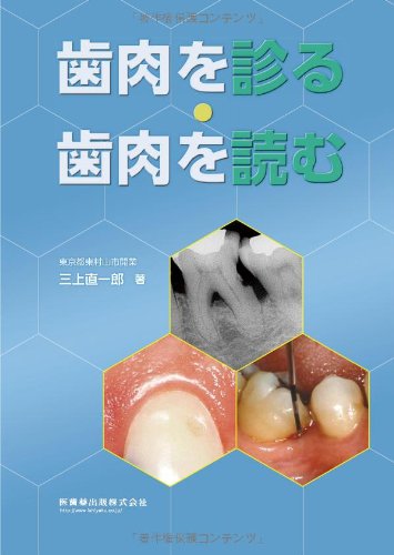 歯肉を診る・歯肉を読む(中古品)