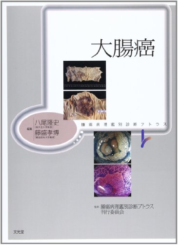 腫瘍病理鑑別診断アトラス　大腸癌(中古品)の通販は 7,386円