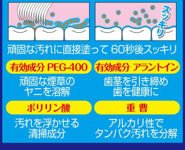 薬用重曹ステインプロ ホワイトニングレーザー ネコポスOK ホワイトニング オーラルケア 白い歯 ヤニ汚れ ステイン 黄ばみ〔mr-2670〕の通販はau  PAY マーケット - セブンパレット au PAY マーケット店