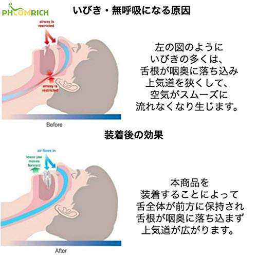 舌ピタ いびき対策 舌用マウスピース 口呼吸 いびき防止グッズ 無呼吸症候群 口呼吸 いびき防止グッズ ランキング 専用 歯ぎしり対策の通販はau Pay マーケット Ajプラザ２号店