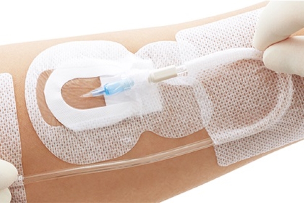 アルケア（ALCARE） 医療用品 フィックスキット・PV クッション付き カテーテル固定専用キット 18892 30セット_1