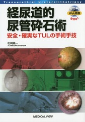 [書籍のメール便同梱は2冊まで]送料無料/[書籍]/経尿道的尿管砕石術 安全・確実なTULの手術手技/松崎純一/著/NEOBK-1853230の通販は