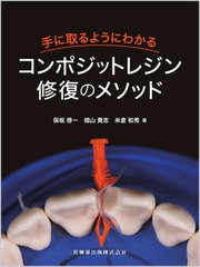 [書籍とのメール便同梱不可]送料無料/[書籍]/手に取るようにわかるコンポジットレジン修/保坂啓一/著 畑山貴志/著 米倉和秀/著/NEOBK-271