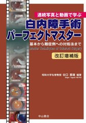 送料無料/[書籍]/白内障手術パーフェクトマスター 連続写真と動画で学ぶ 基本から難症例への対処法まで/谷口重雄/編著/NEOBK-2826087