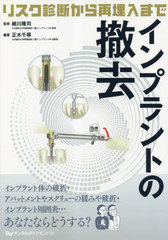 [書籍とのメール便同梱不可]送料無料/[書籍]/インプラントの撤去/細川隆司正木千尋/NEOBK-2848976の通販は 11,000円