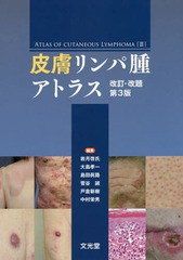 [書籍とのメール便同梱不可]送料無料/[書籍]/皮膚リンパ腫アトラス 改訂・改題 第3版/岩月啓氏/編集 大島孝一/編集 島田眞路/編集 菅谷誠