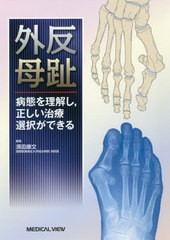 [書籍とのメール便同梱不可]送料無料/[書籍]/外反母趾 病態を理解し正しい治療選択ができる/須田康文/編集/NEOBK-2432296