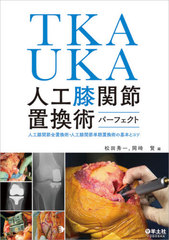 送料無料/[書籍]/TKA・UKA人工膝関節置換術パーフェクト 人工膝関節全置換術・人工膝関節単顆置換術の基本とコツ/松田秀一/編 岡崎賢/編/NEOBK-2620111の通販は
