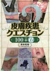 送料無料/[書籍]/皮膚疾患クエスチョン100プラスα/岸本和裕/著/NEOBK-2283435の通販は 7,357円