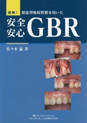 [書籍とのメール便同梱不可]送料無料/[書籍]/図解!遅延型吸収性膜を用いた安全安心GBR/佐々木猛/著/NEOBK-2295304