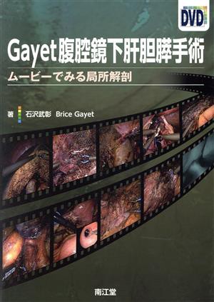 【中古】 Ｇａｙｅｔ腹腔鏡下肝胆膵手術 ムービーでみる局所解剖／石沢武彰(著者)