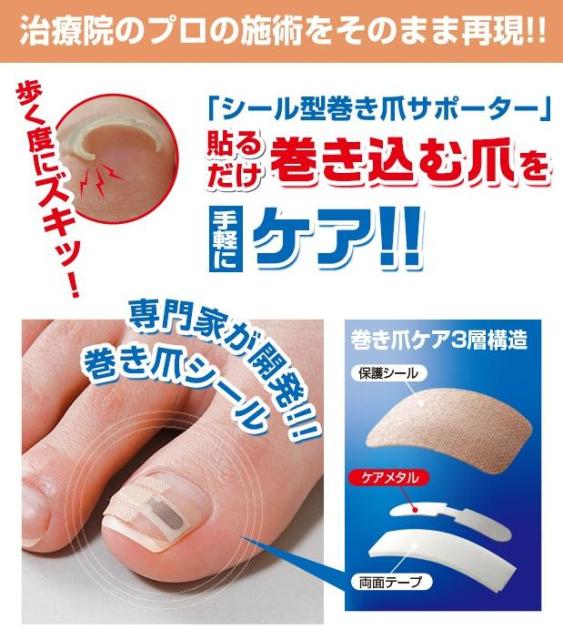 ネコポス発送 送料250円 テーピング 巻き爪シール 1ヶ月ケア 巻きづめ ワイヤー 補正の通販はau Pay マーケット Lunebeauty店 商品ロットナンバー