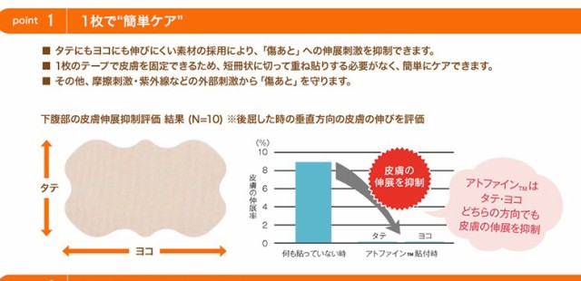 アトファイン ニチバン 帝王切開の傷 手術後 傷 傷あと ケアテープ