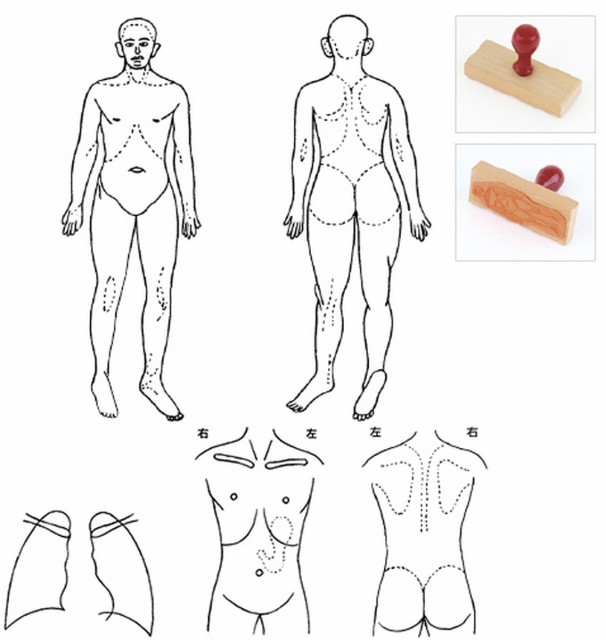 全国配送可 人体図型ゴム印 肺 品番 My24 3050 00 1入り ｍｙ医科器機 の通販はau Wowma ワウマ 文具の月島堂 ａｕ ｗｏｗｍａ 店 商品ロットナンバー