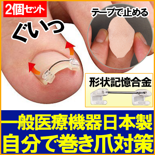 日本製 巻き爪ワイヤーガード 2個セット 一般医療機器 巻き爪 治療 矯正 リフト クリップ 巻爪 ケア テープ ブランド直営 Www Iacymperu Org
