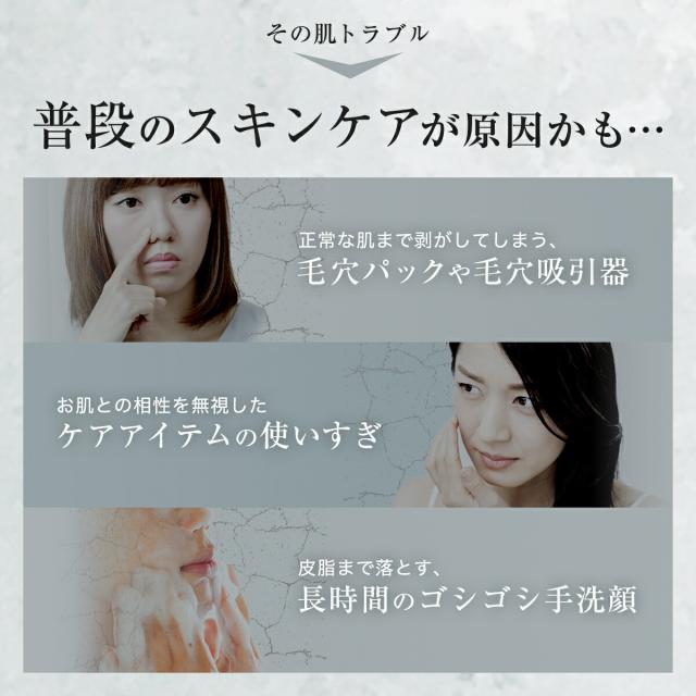 をアップし Skinbaby ホワイト メンズ レディース スキンケア 泡 洗の通販はau Pay マーケット 美容健康専門店wow Medical 商 洗顔器 洗顔ブラシ 小鼻 シリコン 電動 音波 毛穴 黒ずみ 毛穴ケア 超音波洗顔器 シリコン