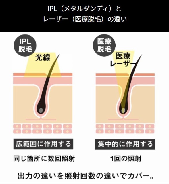 選べるアメニティ付（エトロ・マルジェラ） メタルダンディ metaldandy メンズ脱毛器 Notime｜通販 - au PAY マーケット