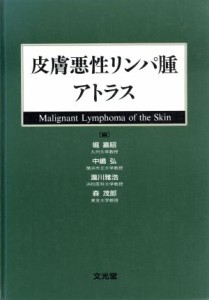 【中古】 皮膚悪性リンパ腫アトラス／堀嘉昭(編者),中嶋弘(編者),瀧川雅浩(編者),森茂郎(編者)