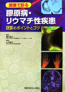 【中古】 画像で診る膠原病・リウマチ性疾患 読影のポイントとコツ／鎌谷直之【監修】，山田隆之【編】