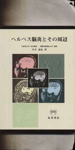 【中古】 ヘルペス脳炎とその周辺／庄司絋史(著者)