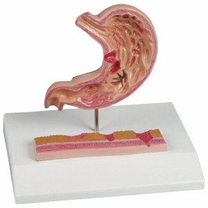 エルラージーマー社 胃潰瘍モデル K217