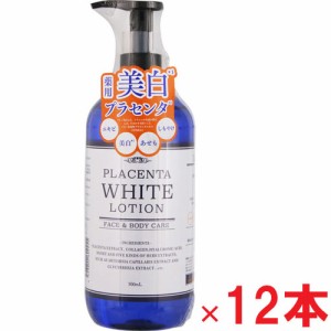 【12本セット】エーフォルム 薬用プラセンタローション 500mL×12本【医薬部外品】（無添加）