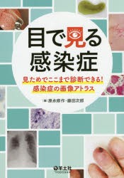 【新品】【本】目で見る感染症　見ためでここまで診断できる!感染症の画像アトラス　原永修作/編　藤田次郎/編