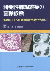 【新品】【本】特発性肺線維症の画像診断　蜂巣肺，IPF/UIP画像診断の理解のために　酒井文和/編集　上甲剛/編集　野間恵之/編集