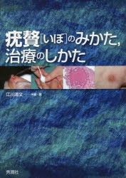 【新品】疣贅(いぼ)のみかた，治療のしかた　江川清文/編・著