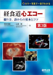 経食道心エコー　カラー写真で一目でわかる　撮り方、診かたの基本とコツ　岡本浩嗣/編　山浦健/編