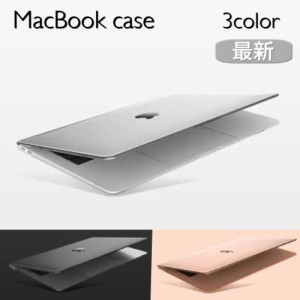 Macbook ケース かわいいの通販 Au Pay マーケット