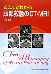 ここまでわかる頭部救急のCT・MRI(中古品)