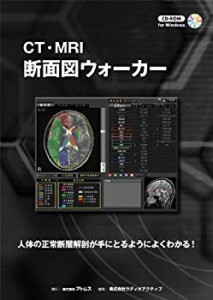 CT・MRI 断面図ウォーカー(中古品)