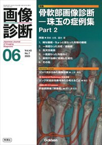 画像診断　２０２３年６月号Ｖｏｌ．４３　Ｎｏ．７  Ｇａｋｋｅｎ  