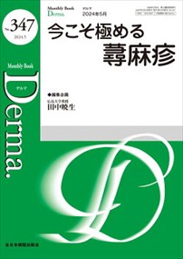 今こそ極める蕁麻疹  ＭＢ　Ｄｅｒｍａ．　Ｎｏ．３４７（２０２４年５月号）  