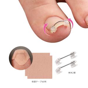 ナースリー 小物 ナースグッズ 看護師 医療 介護 一般医療機器 巻き爪ワイヤーガード の通販はau Pay マーケット ナースリー 看護師通販 Nursery Au Pay マーケット店 商品ロットナンバー