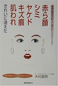 赤ら顔、シミ、ヤケド、キズ痕、肌われきれいに消えた—マグネテラピーで素(中古品)