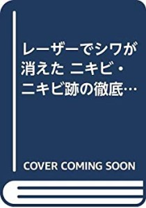 レーザーでシワが消えた ニキビ・ニキビ跡の徹底治療 シミ、アザ、イボ、ホ(中古品)