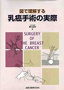 図で理解する乳癌手術の実際(中古品)