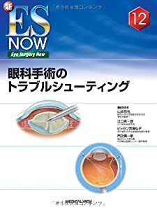 眼科手術のトラブルシューティング (新Eye Surgery Now No. 12)(中古品)