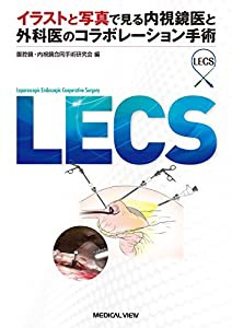 LECS?イラストと写真で見る内視鏡医と外科医のコラボレーション手術(中古品)