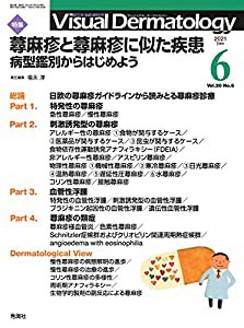 Visual Dermatology Vol.20 No.6 特集:『蕁麻疹と蕁麻疹に似た疾患 ─病型鑑別からはじめよう』 (ヴィジュアルダーマトロジー)( 