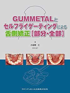 GUMMETALとセルフライゲーティングによる舌側矯正[部分・全部](中古品)