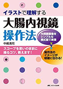 イラストで理解する大腸内視鏡操作法(中古品)