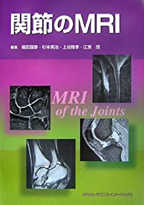 関節のMRI(中古品)