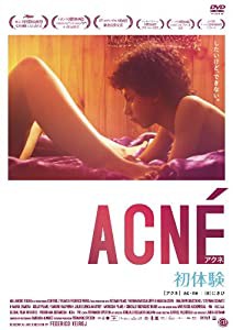 アクネ 初体験 [DVD](中古品)