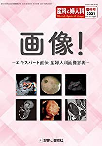 画像! -エキスパート直伝 産婦人科画像診断- 2021年 03 月号 [雑誌]: 産科と婦人科 増刊(中古品)